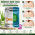 Skin Tag Remover Patch – 30 Patches