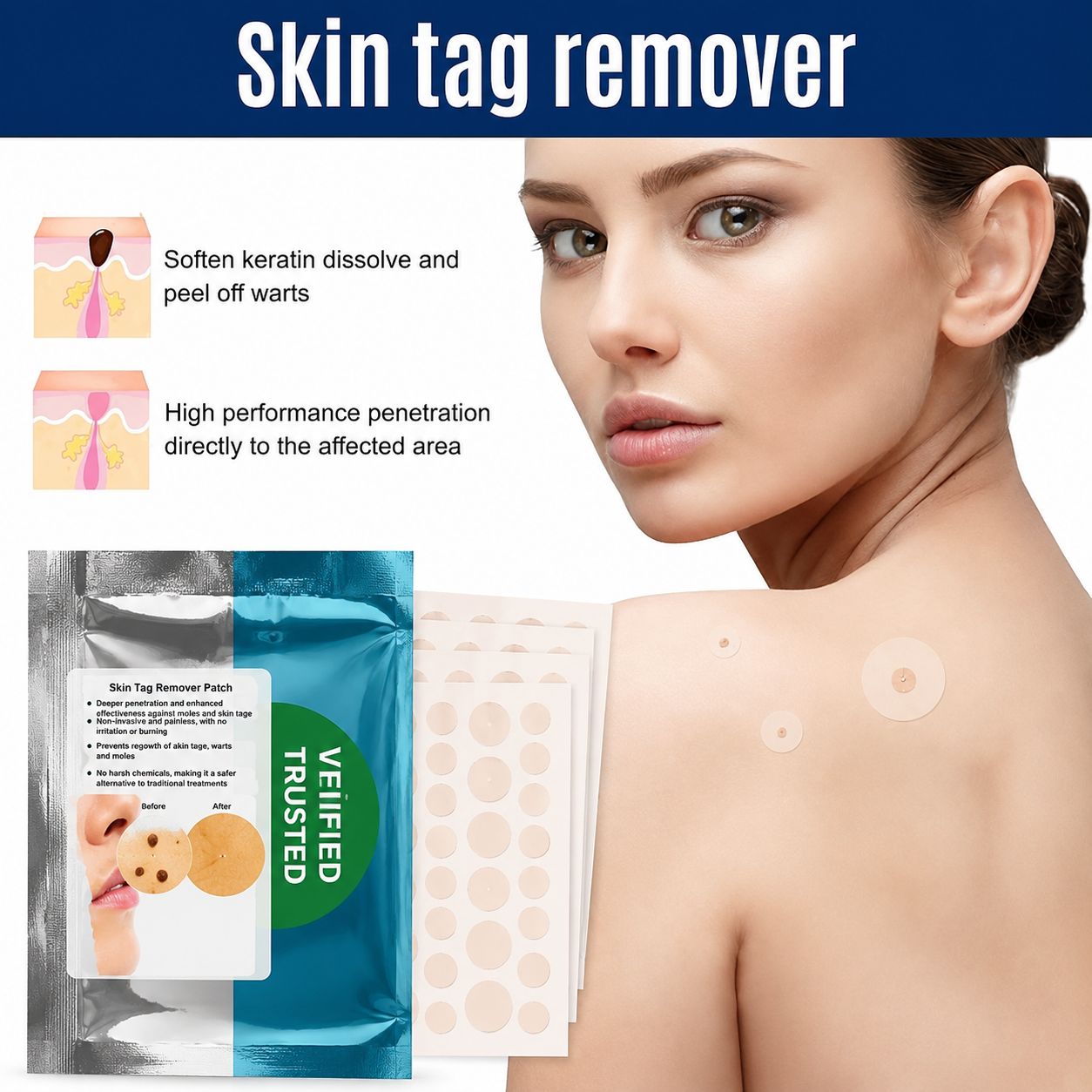 Skin Tag Remover Patch – 30 Patches