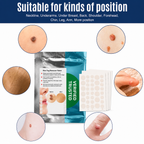 Skin Tag Remover Patch – 30 Patches